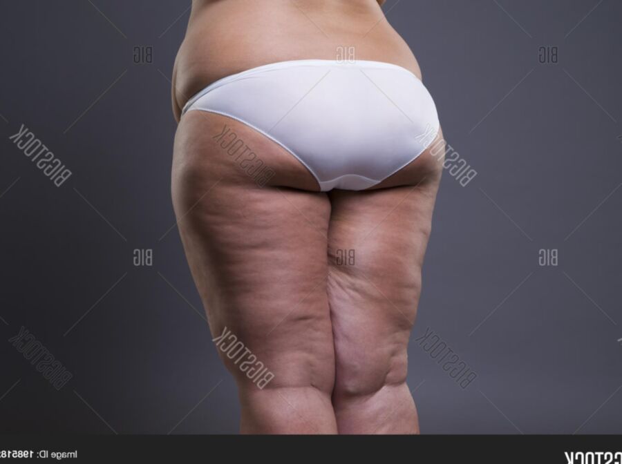 Gros fesses cellulites