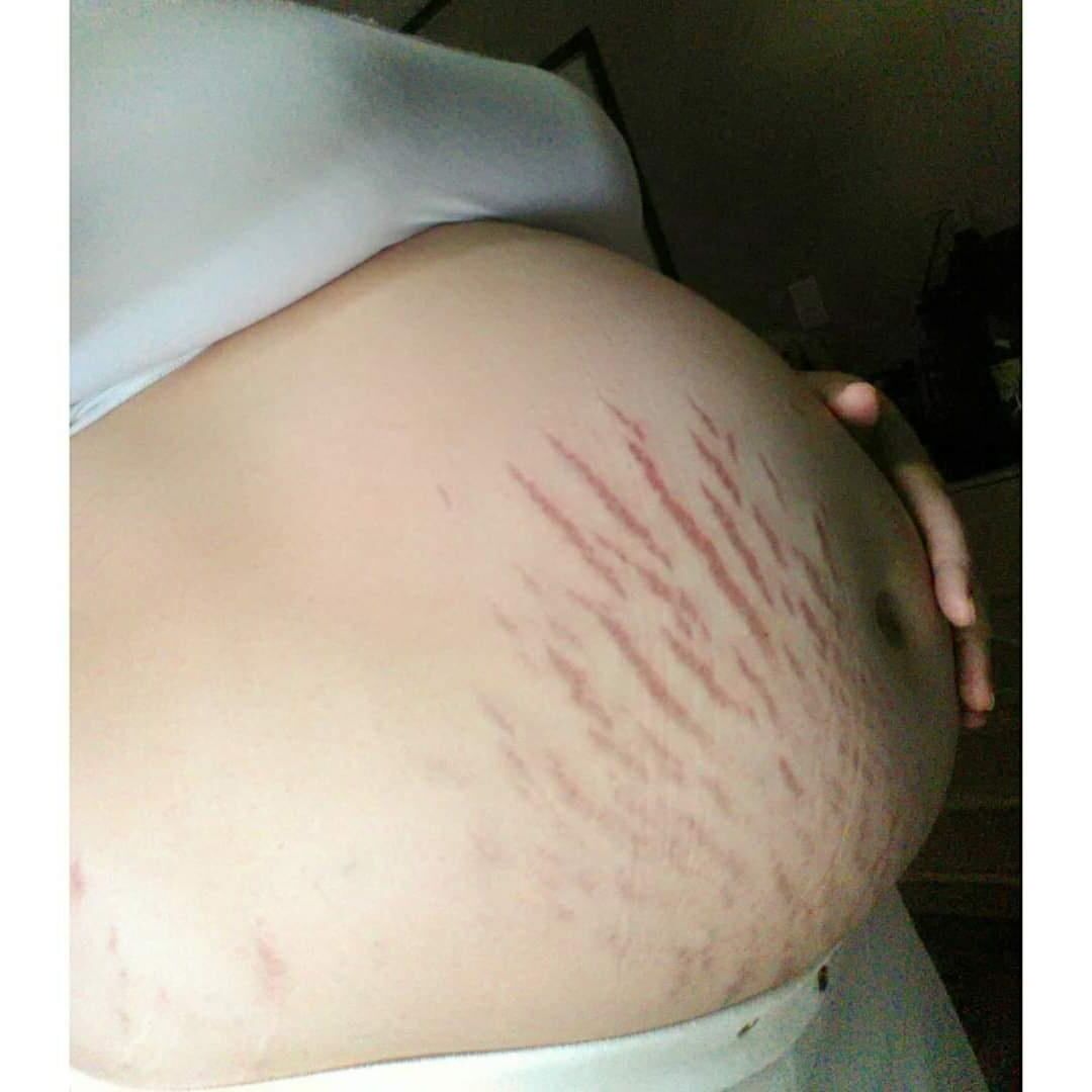 Pregnant teen 19