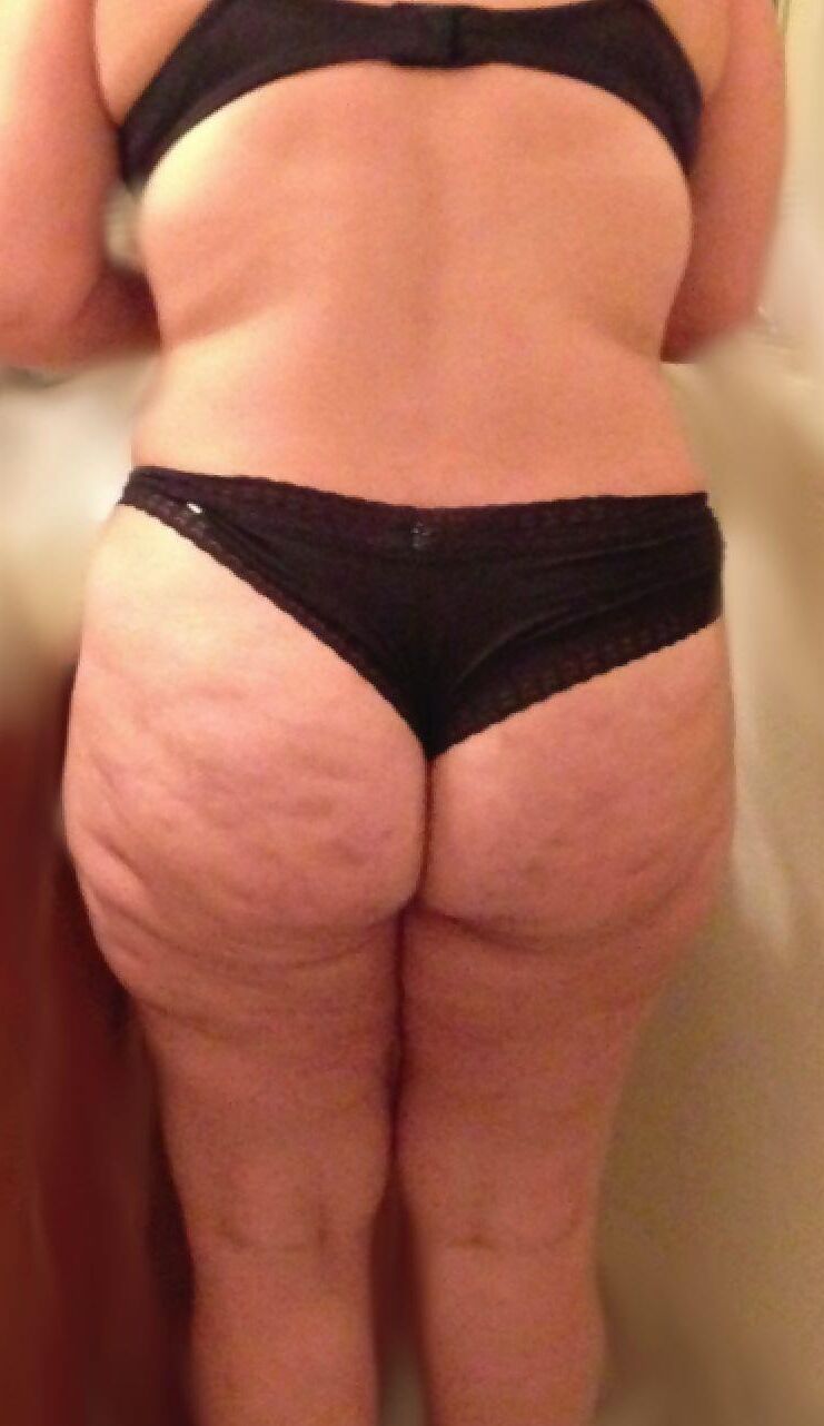 Cellulite ass 