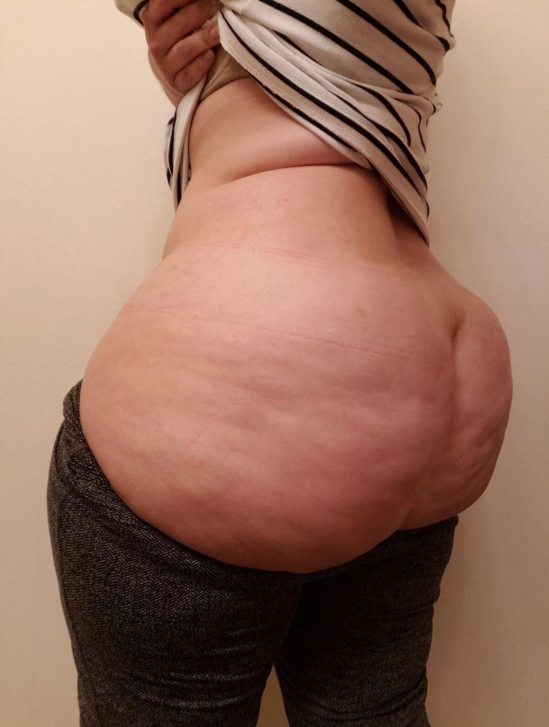 Cellulite ass 