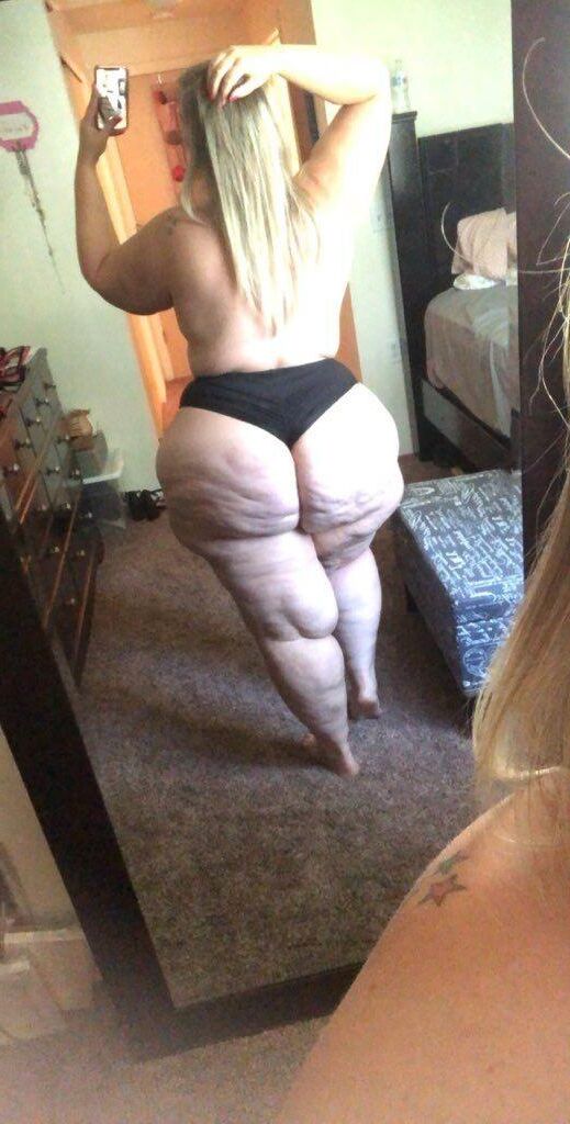 Cellulite ass 