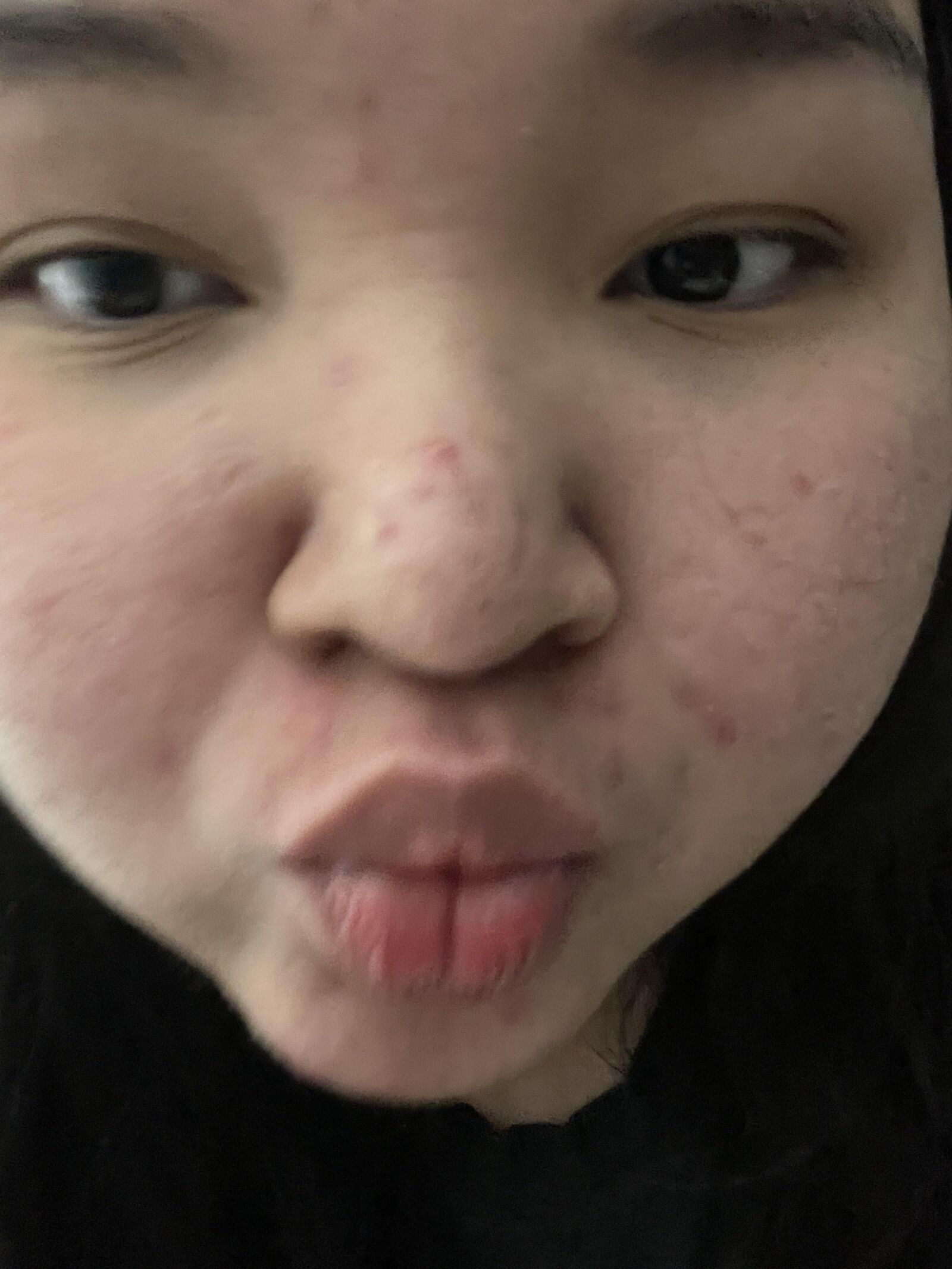 Fat ugly whore wants cum on her lips