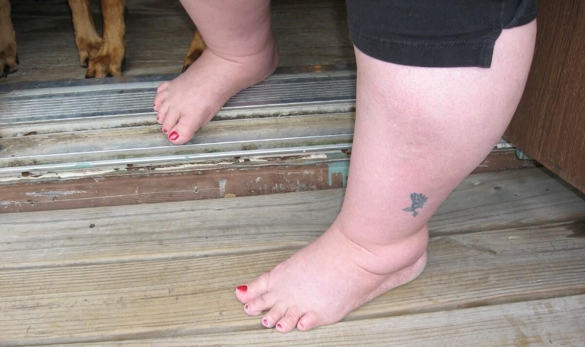 fat feet are fucking sexy