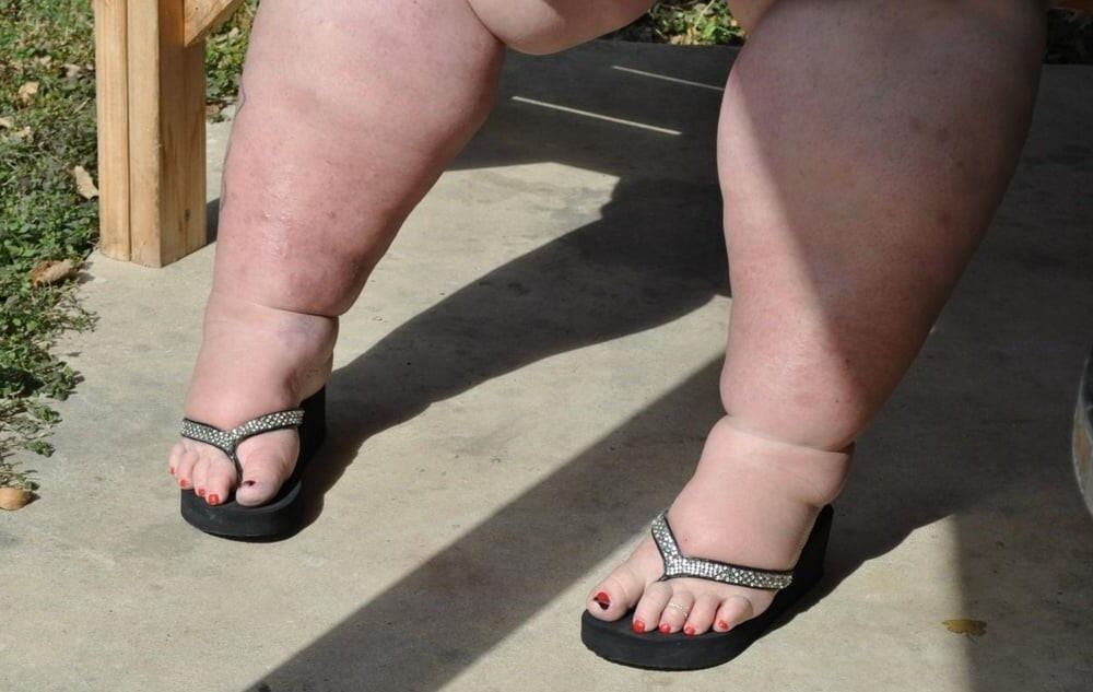 fat feet are fucking sexy