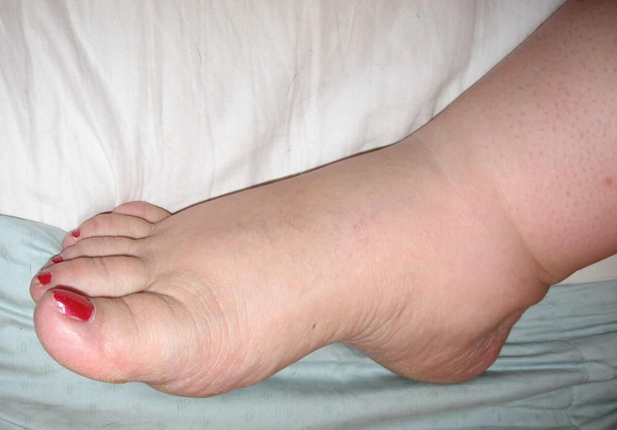 fat feet are fucking sexy