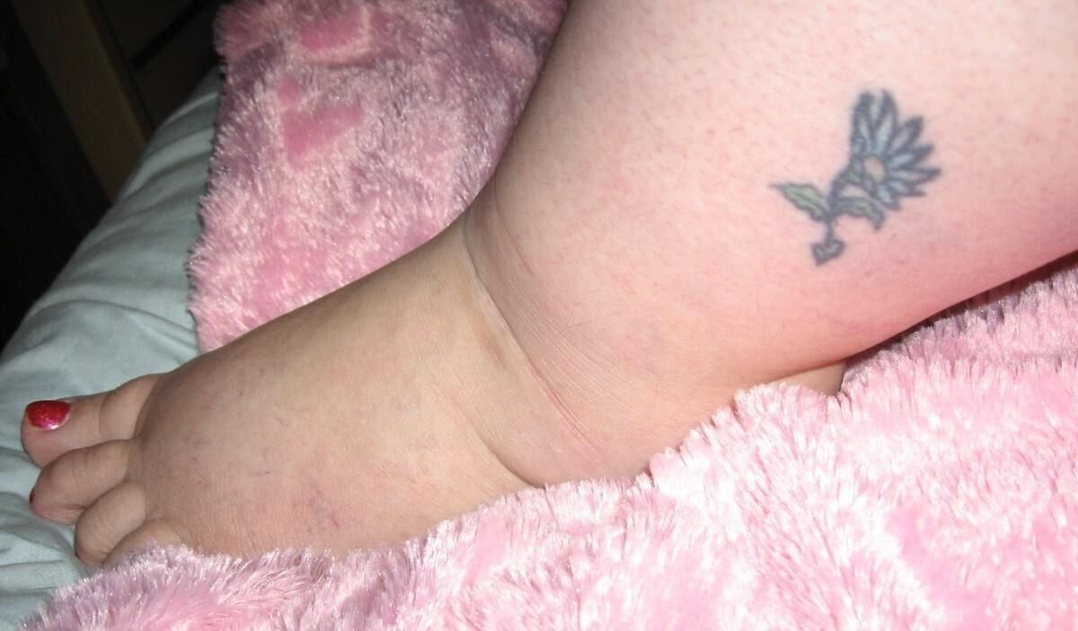 fat feet are fucking sexy