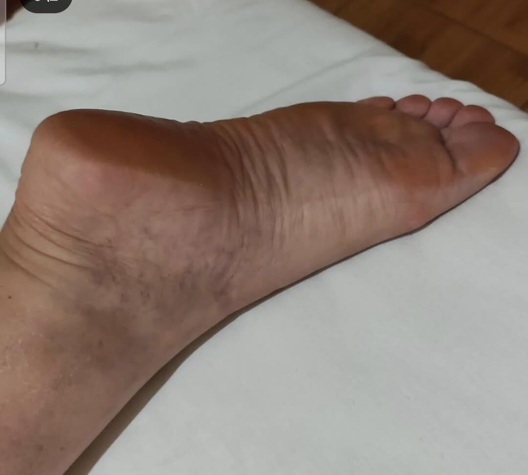 Big, fat, meaty, bbw, ssbbw feet, soles and toes 