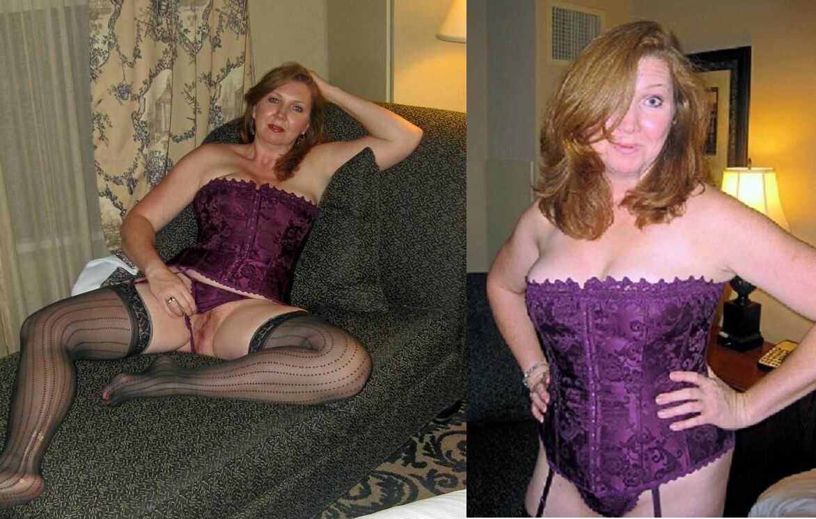 Open legs