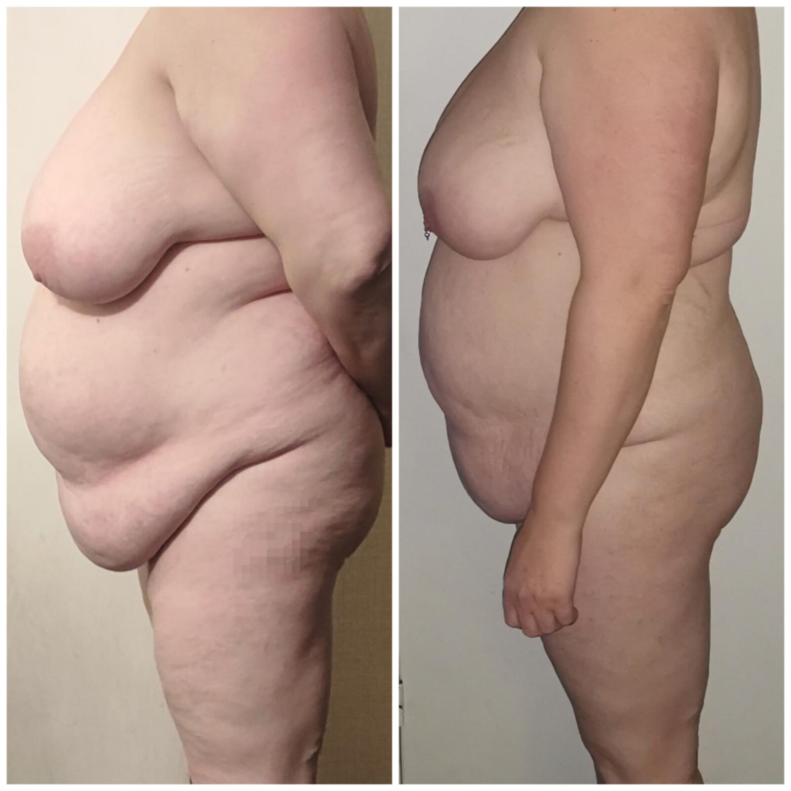 BBW妻格闘