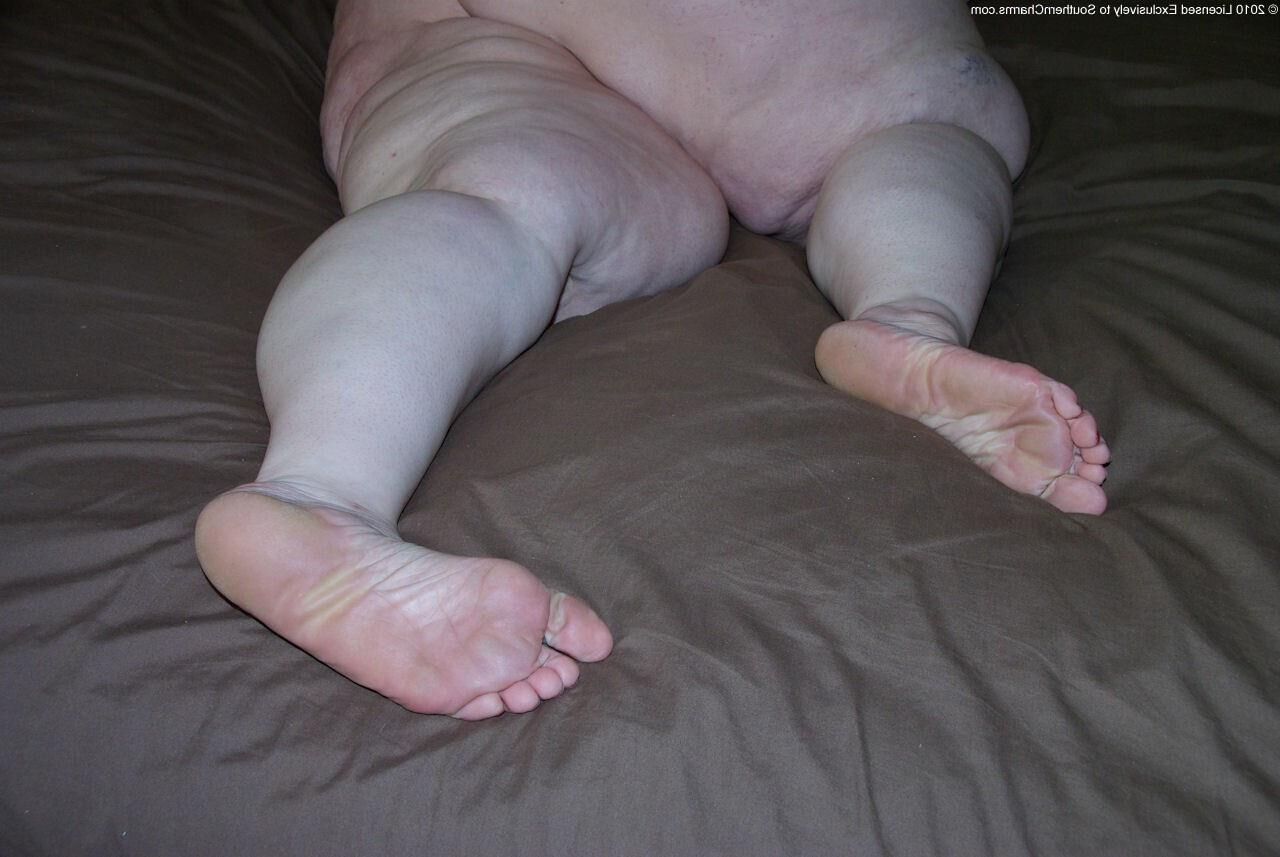 Pieds abimés, qui puent, de grosses, ... 