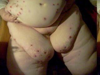 Acné, plaies, peau décolorée