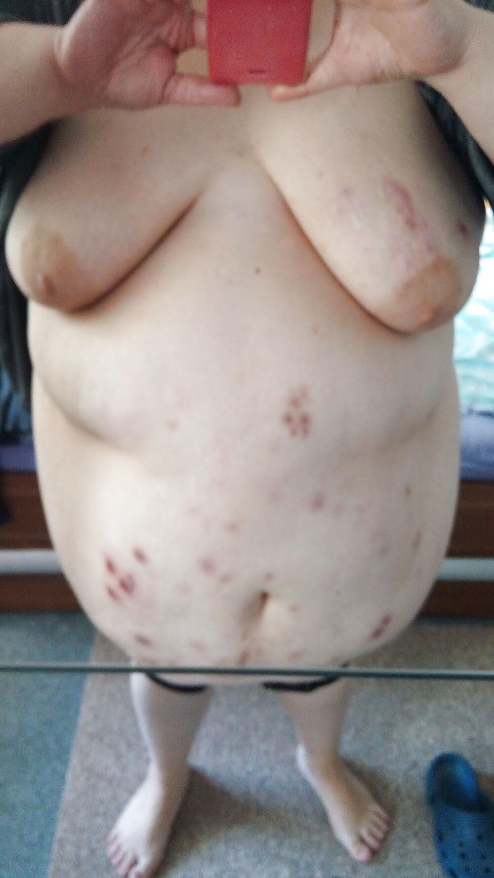 Acné, plaies, peau décolorée