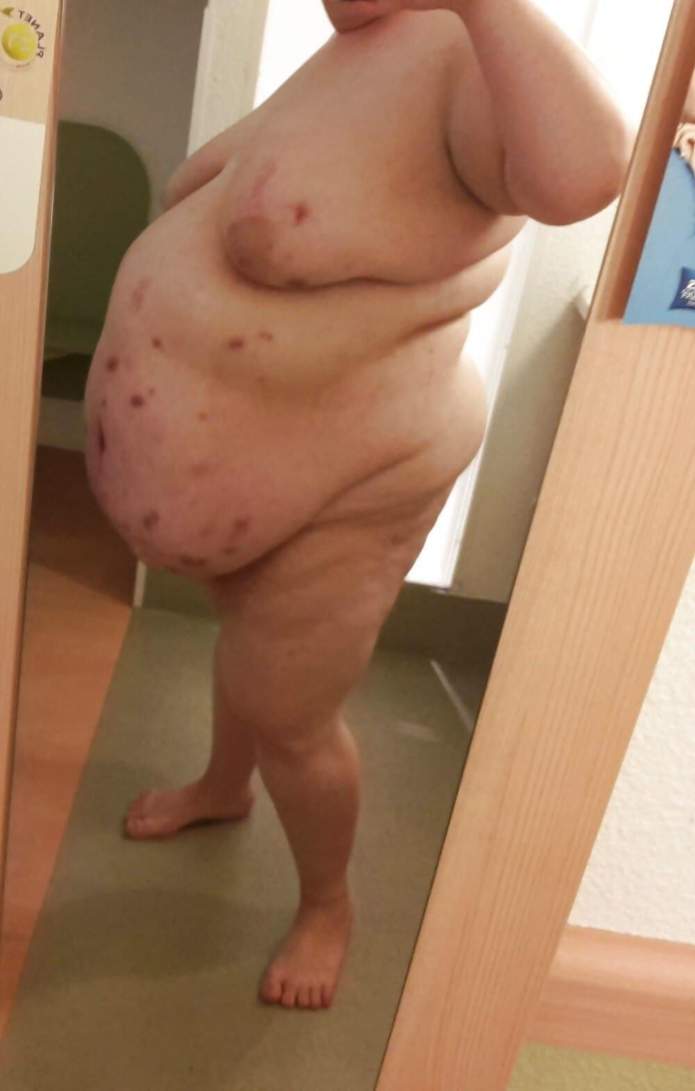 Acné, plaies, peau décolorée