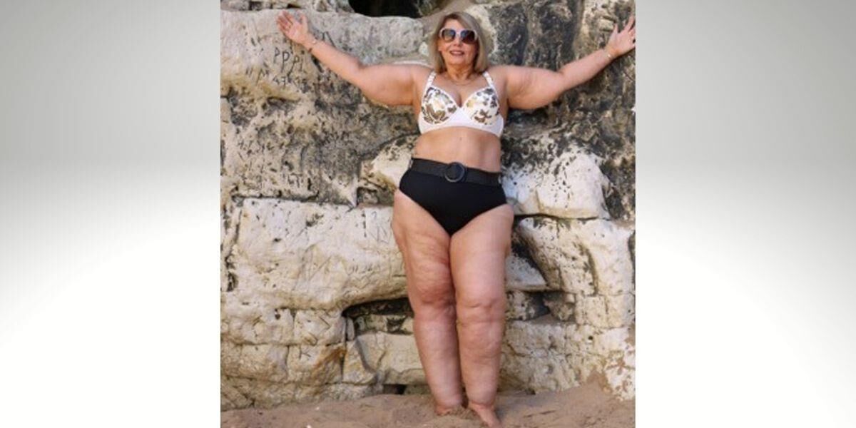 Pernas de celulite de verão