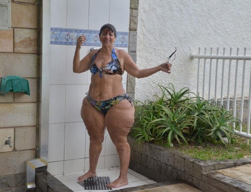 Pernas de celulite de verão