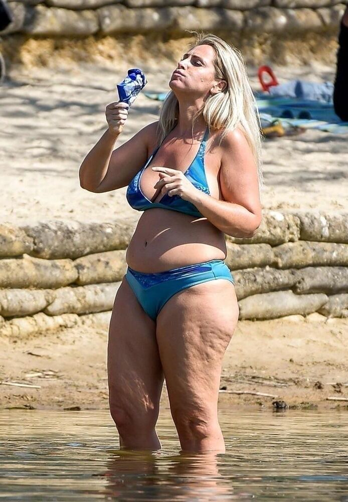 Pernas de celulite de verão