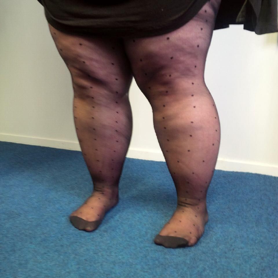 SSBBW pantyhose