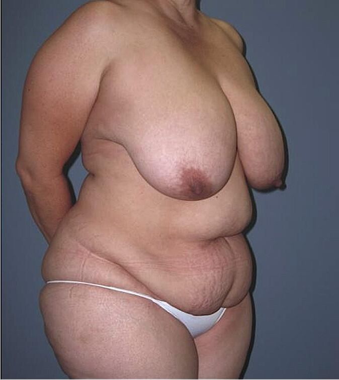 BBWミックス