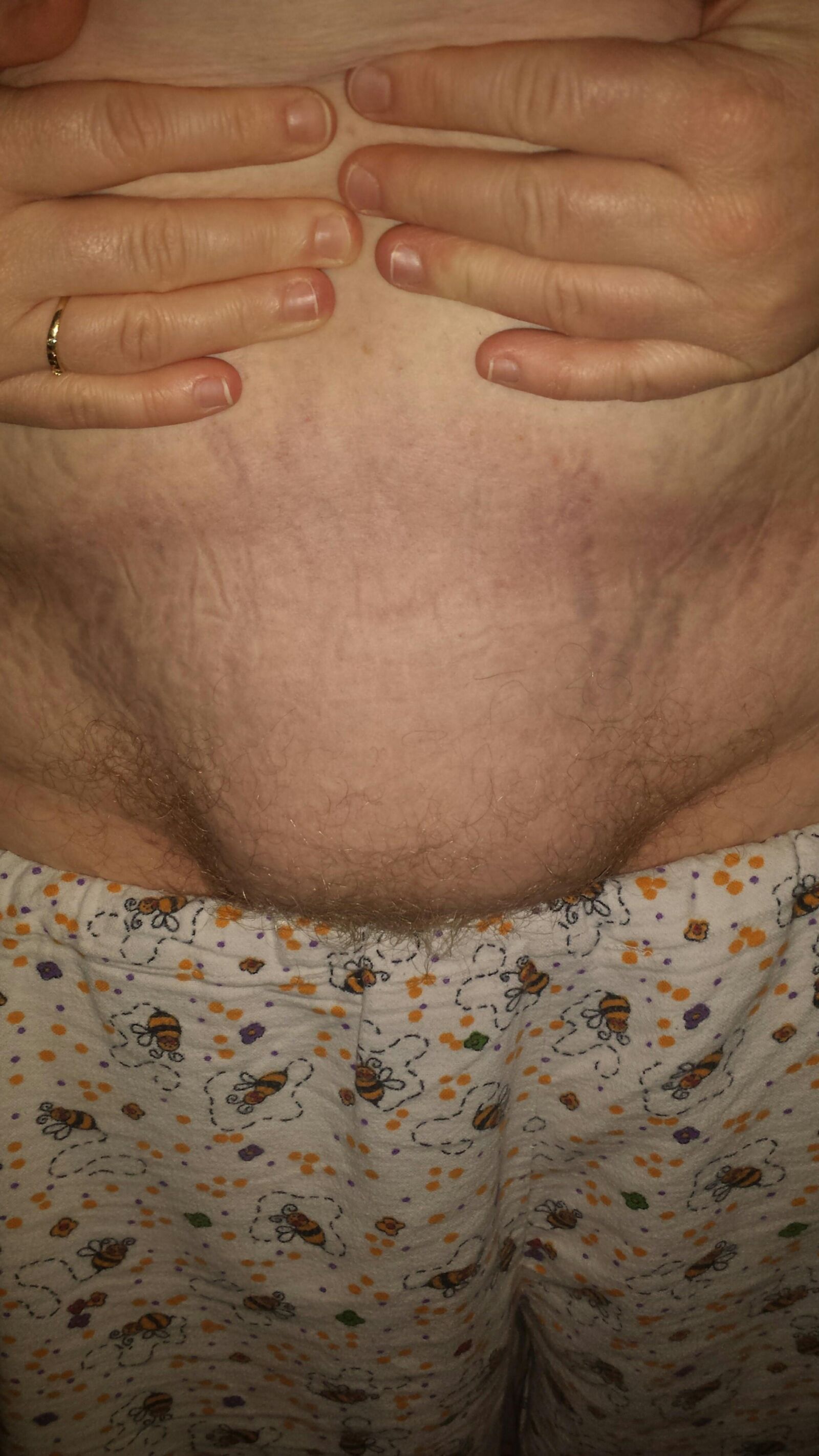 SSBBW Mix 