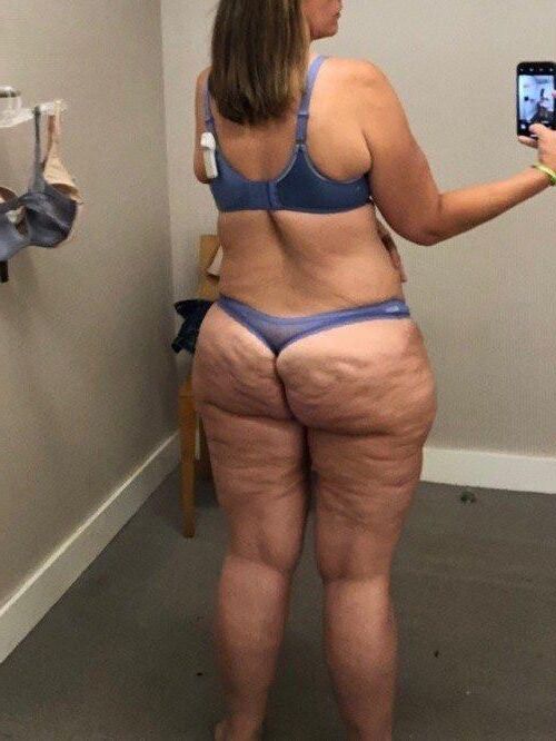 Nur für Cellulite -Liebhaber