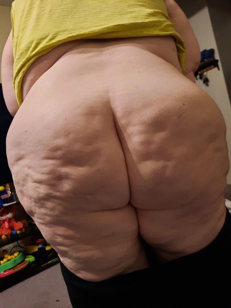 Nur für Cellulite -Liebhaber