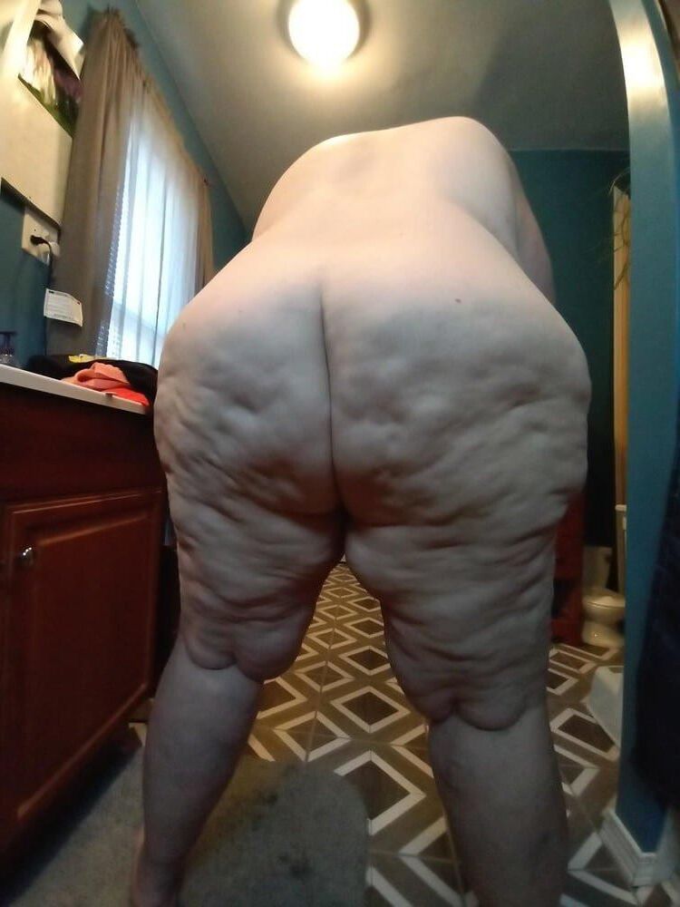 Nur für Cellulite -Liebhaber