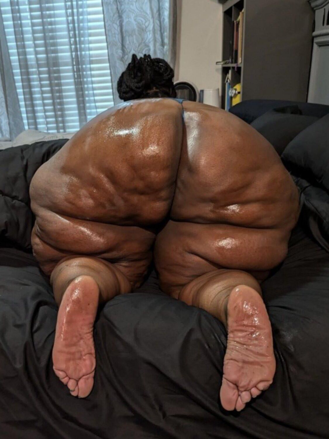 蜂巣炎