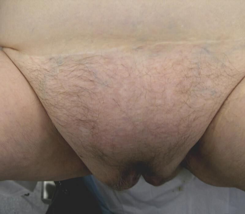 Mix