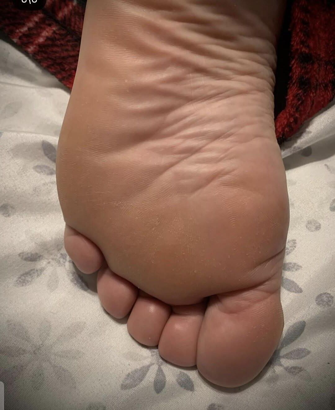Fat feet soles and toes (bbw, ssbbw, ussbbw) 
