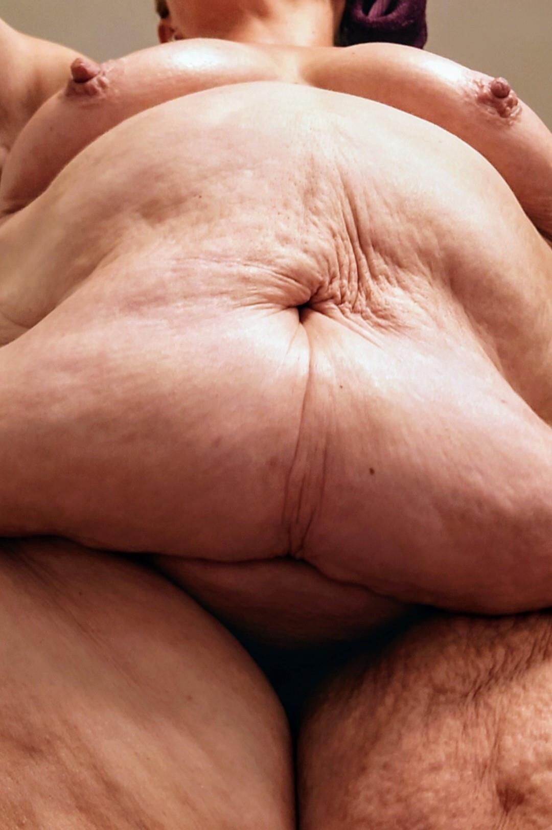 Lindas bebês de celulite