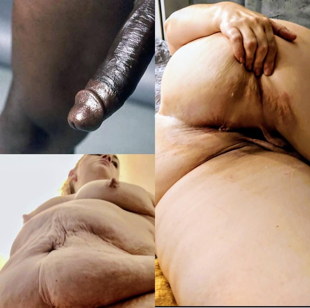 Lindas bebês de celulite