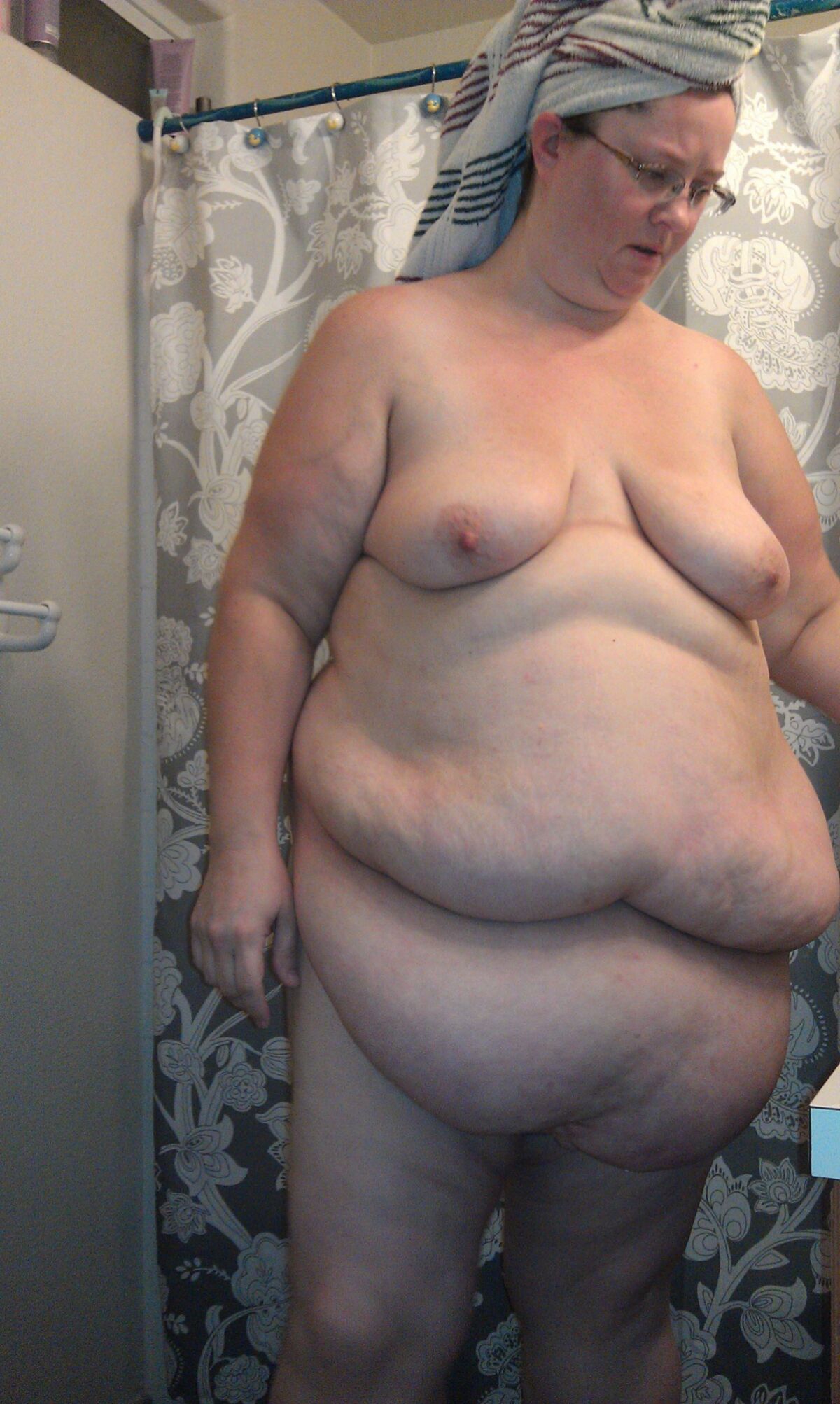 Titless obese women 
