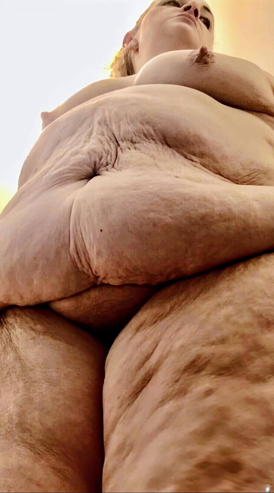 Lindas bebês de celulite