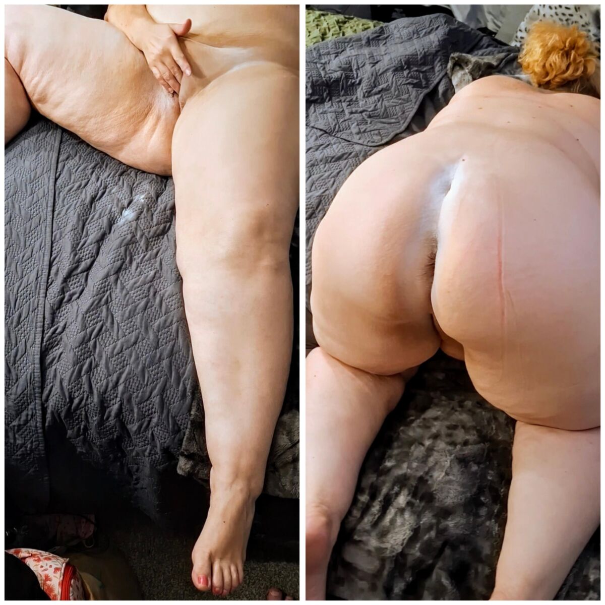 Lindas bebês de celulite