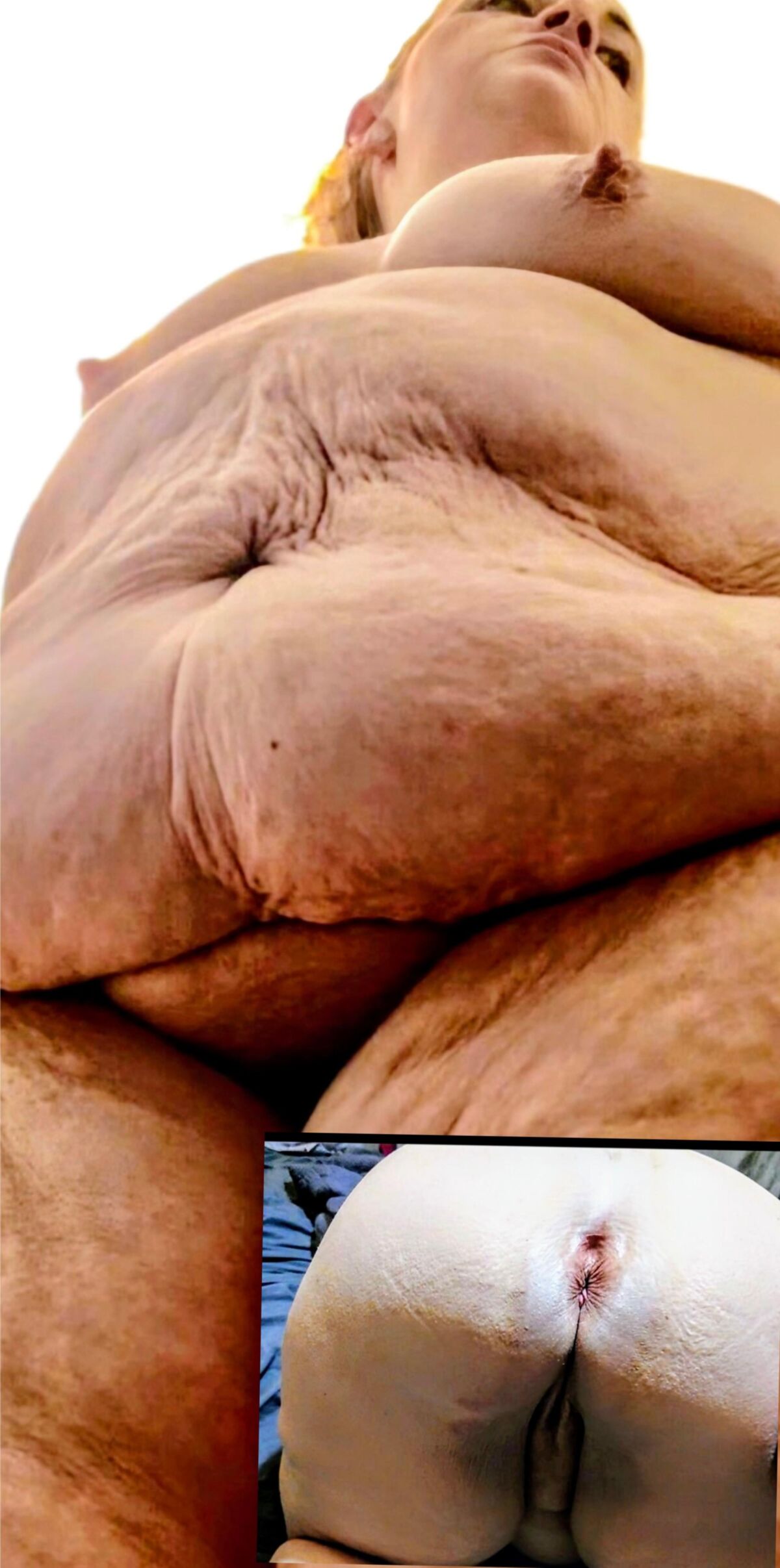 Lindas bebês de celulite