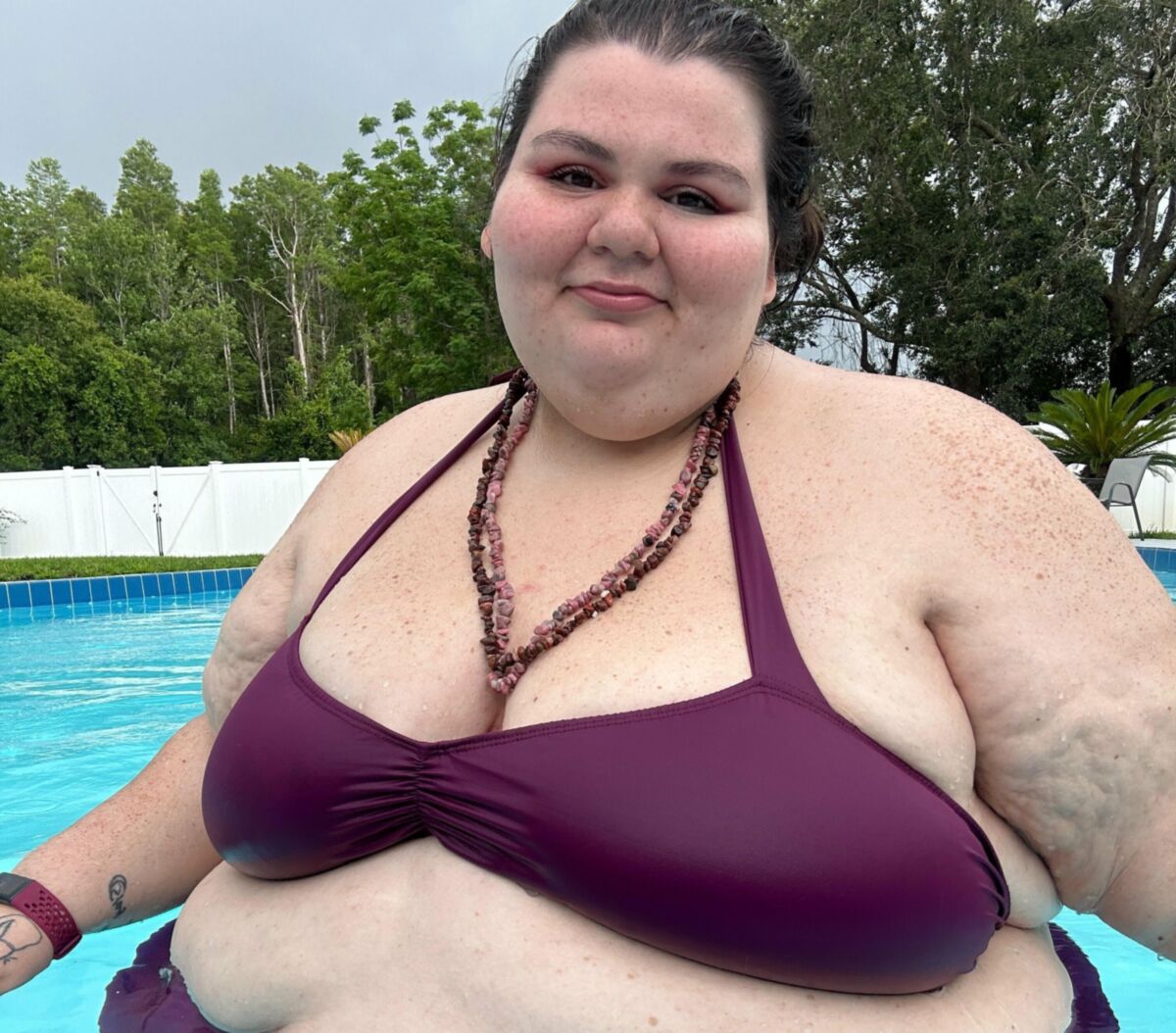 Titless obese women 
