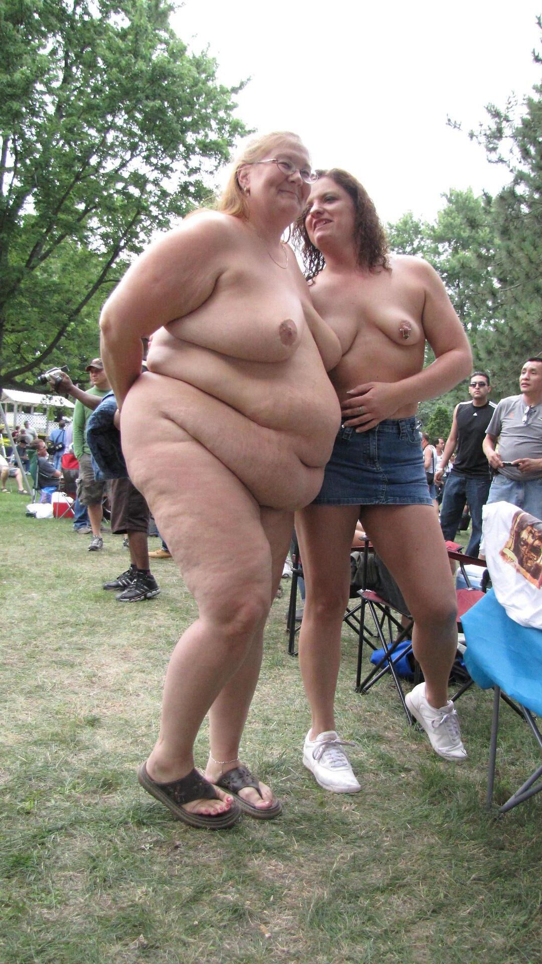 Cellulite Bunds e coxas ()