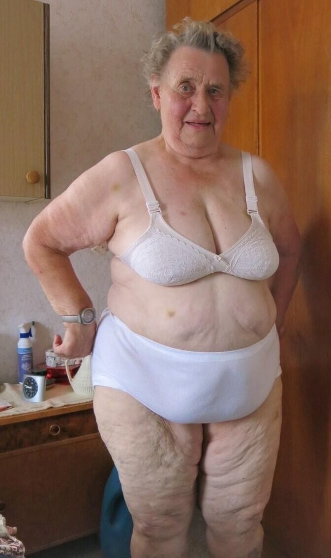 Cellulite Bunds e coxas ()