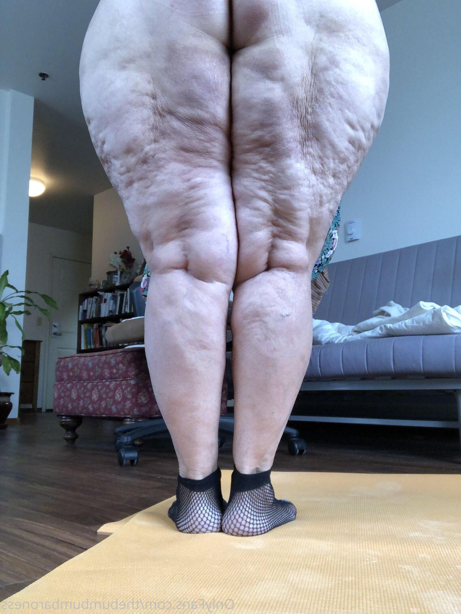 Cellulite Bunds e coxas ()