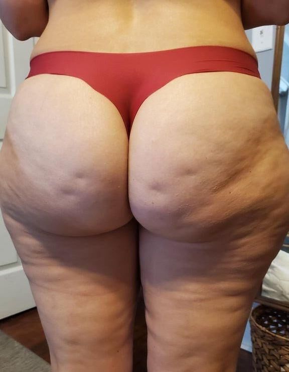 Cellulite Macht Geil