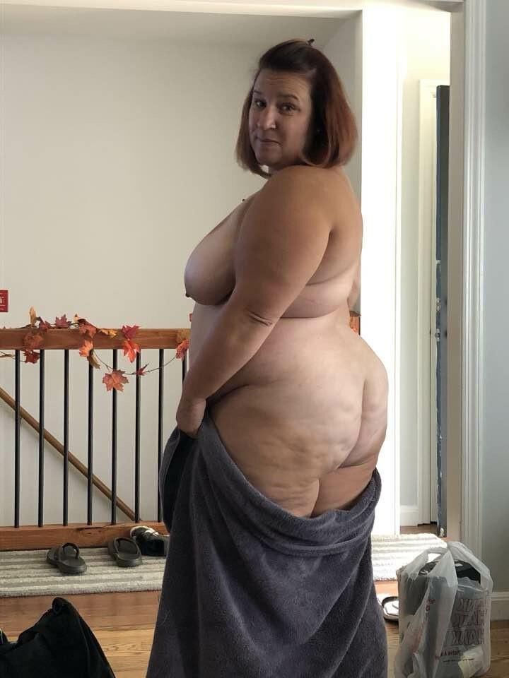 Cellulite 